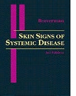 Skin Signs of Systemic Disease - Irwin M. Braverman