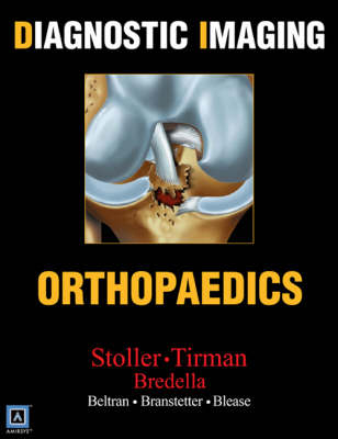 Orthopaedics - D. W. Stoller, Phillip F.J. Tirman, Miriam A. Bredella