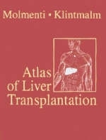 Atlas of Liver Transplantation - Ernesto P. Molmenti, Goran B. Klintmalm