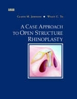 A Case Approach to Open Structure Rhinoplasty - Calvin M. Johnson, Wyatt C. To