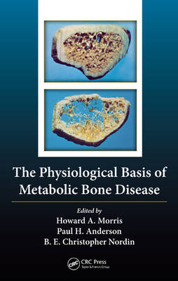 The Physiological Basis of Metabolic Bone Disease - 