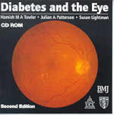 Diabetes and the Eye - Hamish Towler, Julian Patterson, Susan Lightman