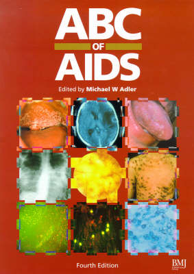 ABC of AIDS - 