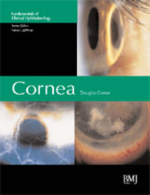 Cornea - Prof Douglas Coster