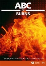 ABC of Burns - 