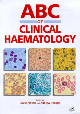 ABC of Clinical Haematology - 