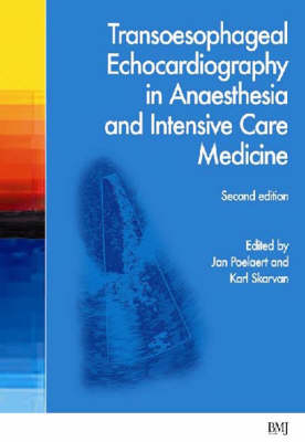 Transoesophageal Echocardiography in Anaesthesia and Intensive Care Medicine - 