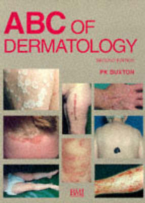 ABC of Dermatology - Paul K. Buxton