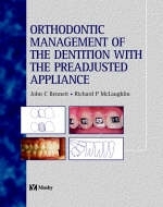Orthodontic Management of the Dentition with the Pre-Adjusted Appliance - John C. Bennett, Richard P. McLaughlin