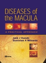 Diseases of the Macula - Jack J. Kanski, Stanislaw A. Milewski