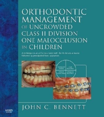 Orthodontic Management of Uncrowded Class II Division One Malocclusion in Children - John C. Bennett