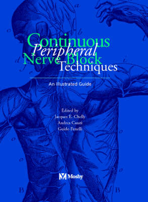 Continuous Peripheral Nerve Blocks - Jacques Chelly, Guido Fanelli, Andrea Casati