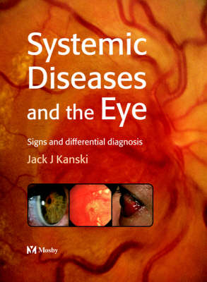 Systemic Diseases and the Eye - Jack J. Kanski