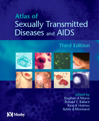 Atlas of Sexually Transmitted Diseases and AIDS - Stephen A. Morse, Ronald C. Ballard, King K. Holmes, Adele A. Moreland