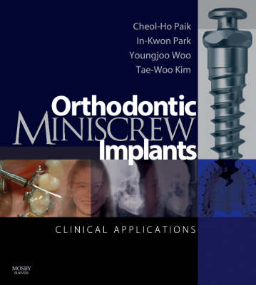 Orthodontic Miniscrew Implants - Inkwon Park, Cheol-Ho Paik, Youngjoo Woo, Tae-Woo Kim