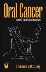 Oral Cancer - George Dimitroulis, Brian Avery