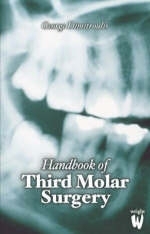 Synopsis of Third Molar Surgery - George Dimitroulis
