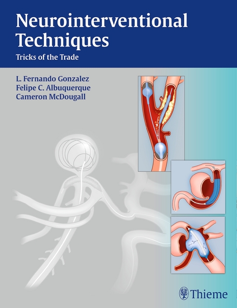 Neurointerventional Techniques - Fernando Gonzalez