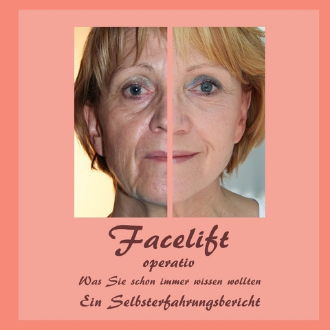 Facelift operativ -  Bernhard Siegmund,  Ute Fischer