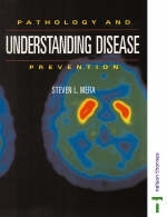 Understanding Disease - Steven L. Mera