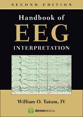 Handbook of EEG Interpretation - William O. Tatum IV