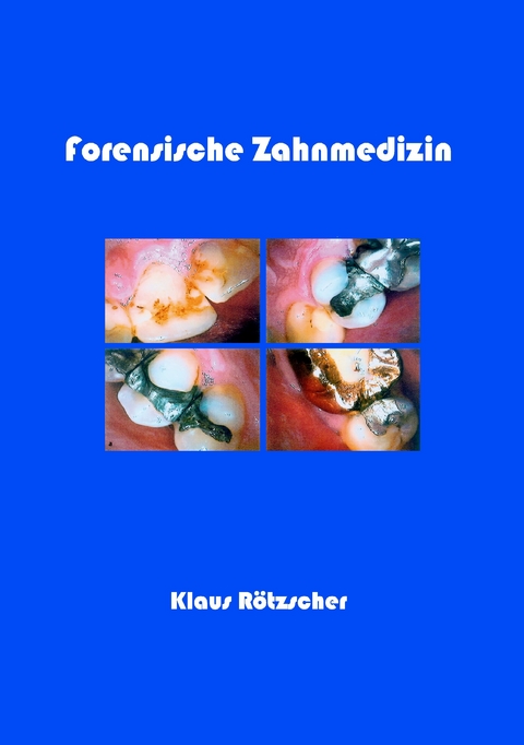 Forensische Zahnmedizin - 