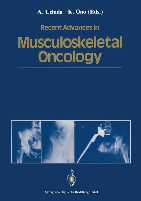 Recent Advances in Musculoskeletal Oncology - 