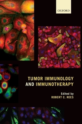 Tumor Immunology and Immunotherapy - 