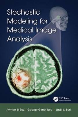 Stochastic Modeling for Medical Image Analysis -  Ayman El-Baz,  Georgy Gimel’farb,  Jasjit S. Suri