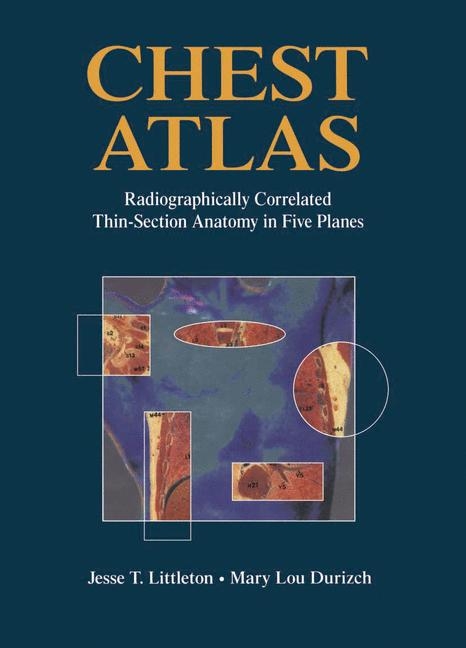 Chest Atlas -  Mary L. Durizch,  Jesse T. Littleton