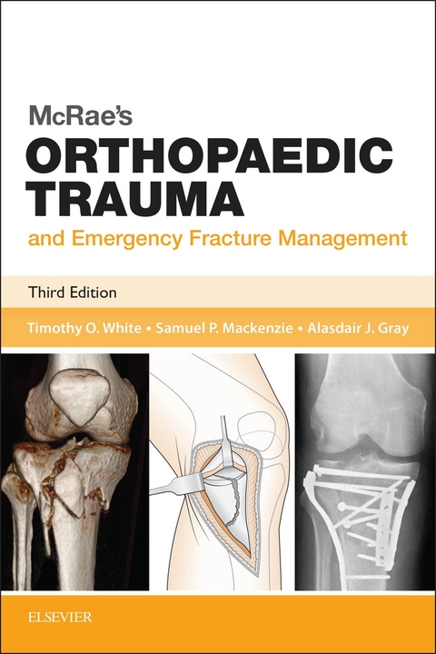 McRae's Orthopaedic Trauma and Emergency Fracture Management -  Timothy O White,  Samuel P Mackenzie,  Alasdair J Gray