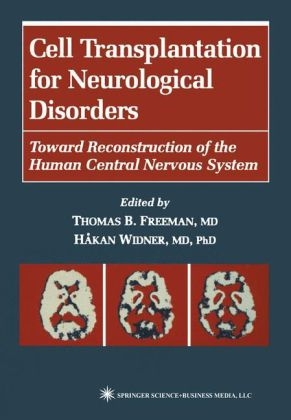 Cell Transplantation for Neurological Disorders - 