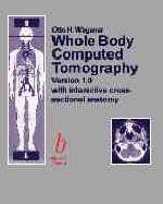Whole Body Computed Tomography - O.H. Wegener