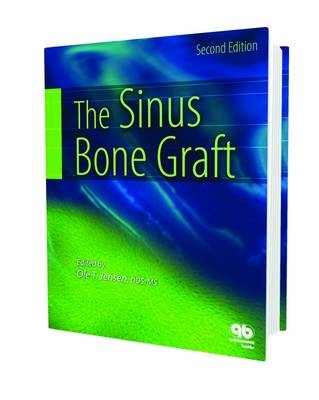Sinus Bone Graft - 