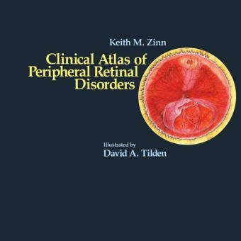 Clinical Atlas of Peripheral Retinal Disorders -  Keith M. Zinn