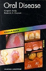 Oral Disease - Crispian Scully, Roderick A. Cawson