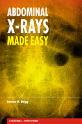 Abdominal X-rays Made Easy - Dr. James D. Begg