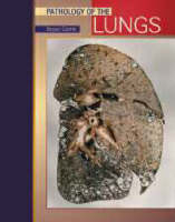 Pathology of Lung Tumors - 