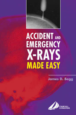 Accident and Emergency X-Rays Made Easy - James D. Begg