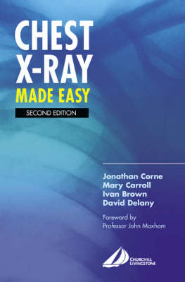 Chest X-Ray Made Easy - Jonathan Corne, Mary Carroll, David Delany, Ivan Brown