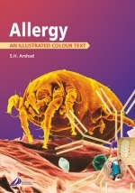 Allergy - S. Hasan Arshad