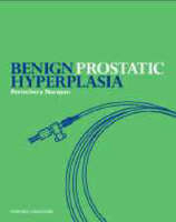Benign Prostatic Hyperplasia - Perinchery Narayan