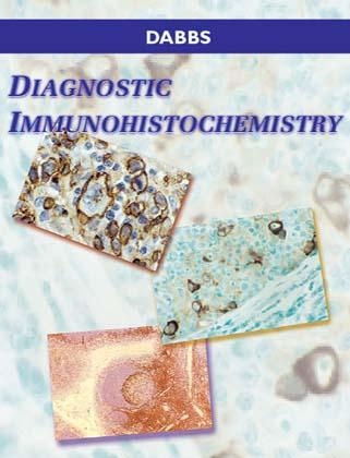 Diagnostic Immunohistochemistry - David J. Dabbs