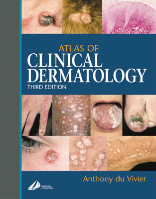 Atlas of Clinical Dermatology - Anthony du Vivier