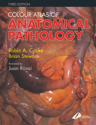 Colour Atlas of Anatomical Pathology - Robin A. Cooke, Brian Stewart