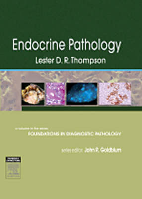 Endocrine Pathology - 