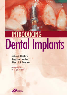 Introducing Dental Implants - John A. Hobkirk, Roger M. Watson, Lloyd Searson