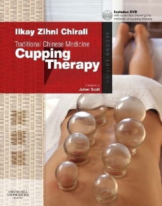 Traditional Chinese Medicine Cupping Therapy - Ilkay Z. Chirali