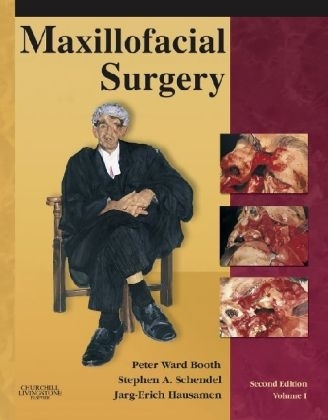 Maxillofacial Surgery - Peter Ward-Booth, Stephen A. Schendel, Jarg-Erich Hausamen