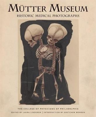 Mtter Museum Historic Medical Photographs -  College of Physicians of Philadelphia